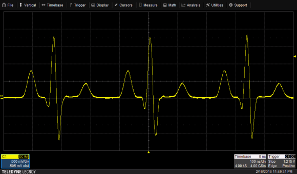 Abb. 1 - Beispielsignal - EKG Kurvenform